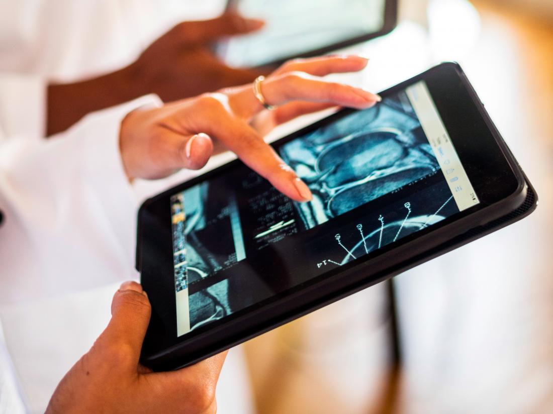 a doctor looking at a CT scan or MRI on an ipad. 